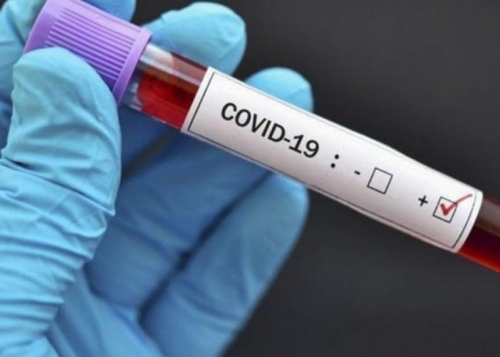 В Грузии фиксируют рост случаев коронавируса: 7812 заболели, выздоровели 4764 человека