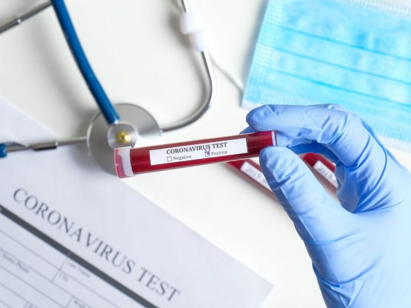 В Армении зарегистрировано 263 новых случая заражения коронавирусом и 15 смертей
