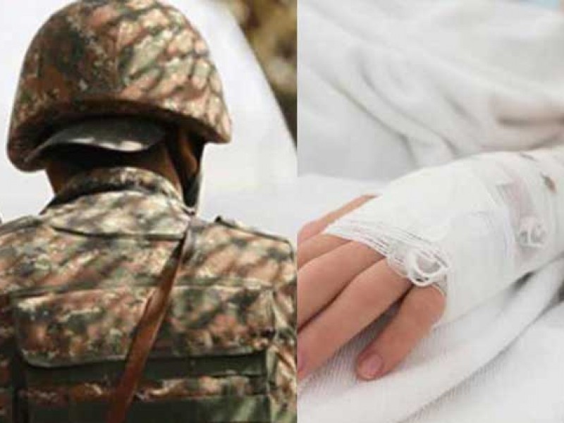 Тяжелое и средней тяжести: Минобороны Армении сообщило о состоянии раненых 