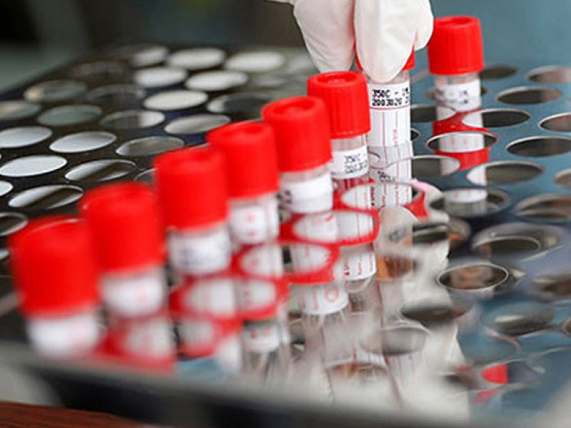 В Арцахе за сутки выявлено 43 новых случая заражения коронавирусом 