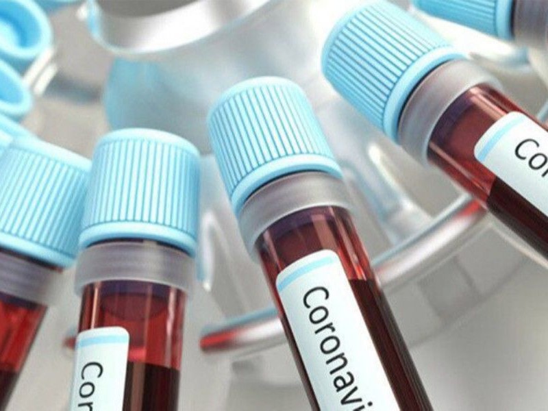 Коронавирус в Арцахе: 52 новых случая заболевания за сутки