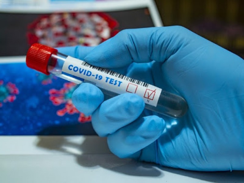 Плюс 11: число случаев коронавируса в Арцахе достигло 228