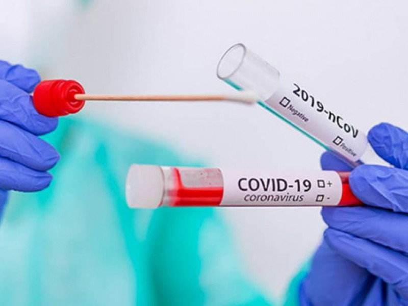 Директор ФБР: источником пандемии коронавируса стала лабораторная утечка в Ухане