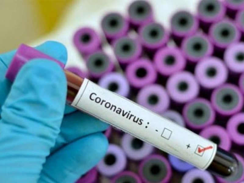 Один из зараженных коронавирусом - житель Эчмиадзина 