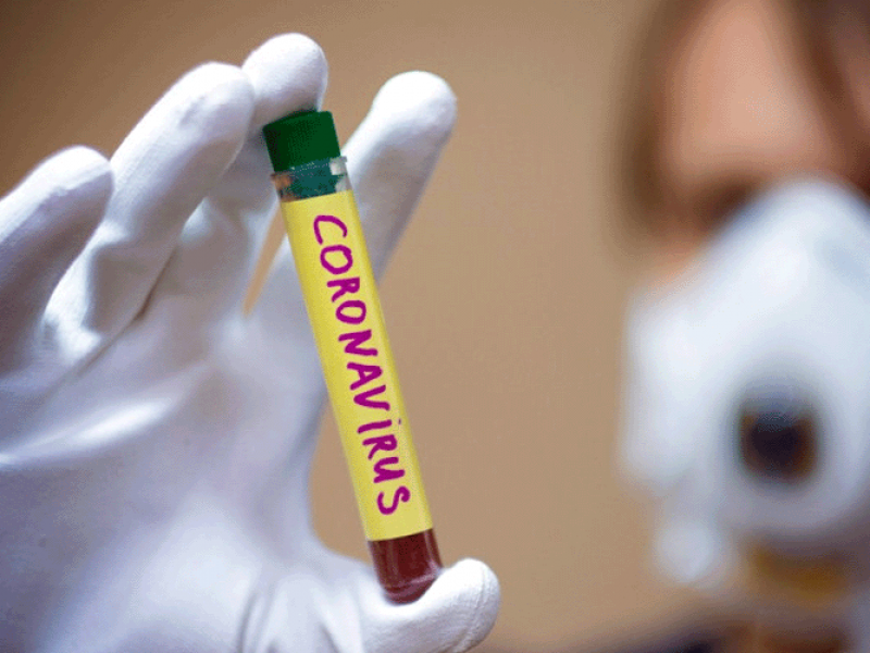 Плюс 1: число случаев коронавируса в Арцахе достигло 277