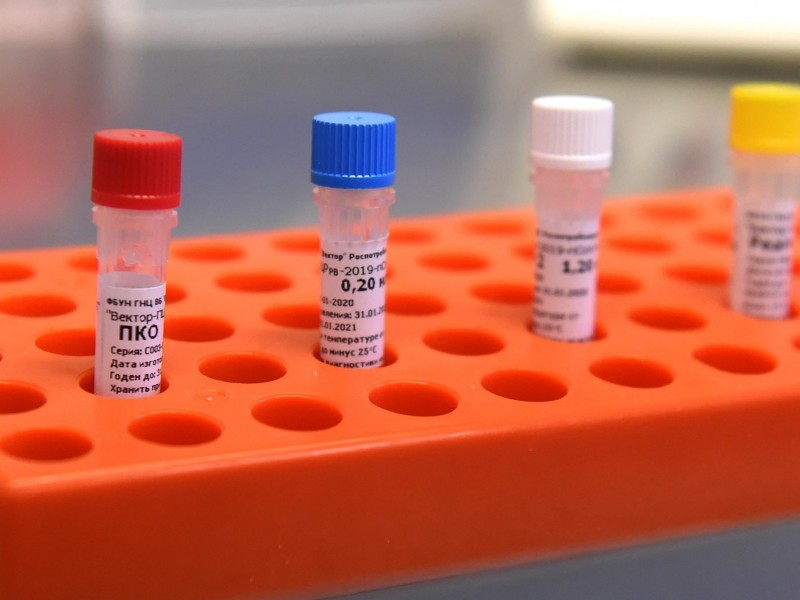 Կորոնավիրուսը գրոհում է. վարակվելու 2556 նոր դեպք, 3 մահ մեկ օրում 