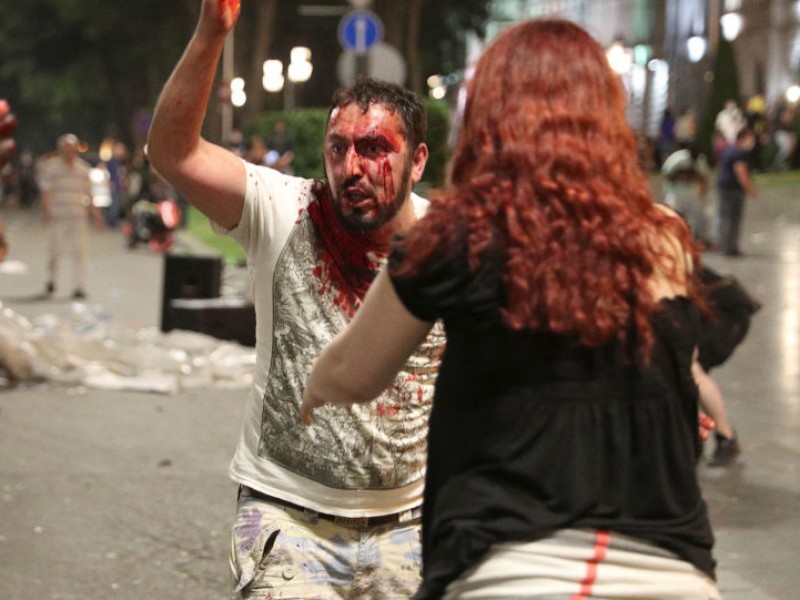 Полиция в Тбилиси применила слезоточивый газ, звучат выстрелы: есть десятки раненых (LIVE)