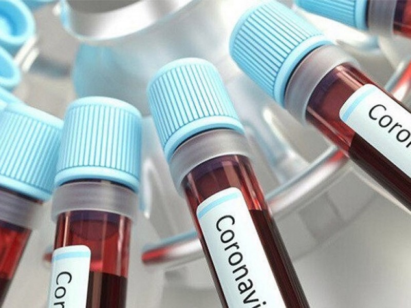 Коронавирус в Арцахе: 71 новый случай заболевания за сутки