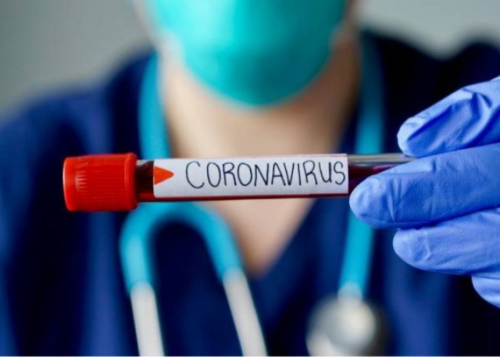 Плюс 73: в Армении число инфицированных коронавирусом увеличилось до 1596