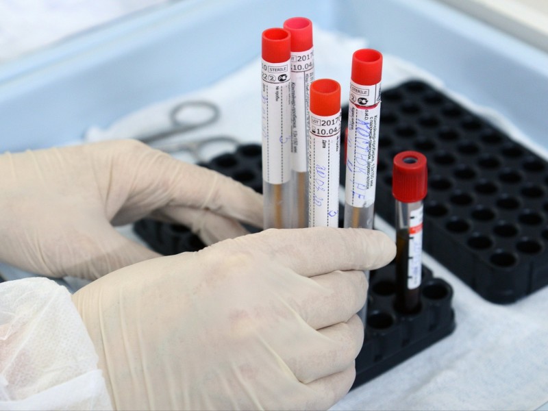 Иран начнет экспорт тест-систем для диагностики коронавируса