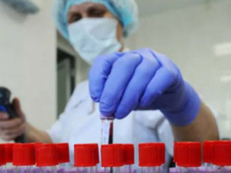 В Арцахе выявлено 13 случаев заболевания коронавирусом