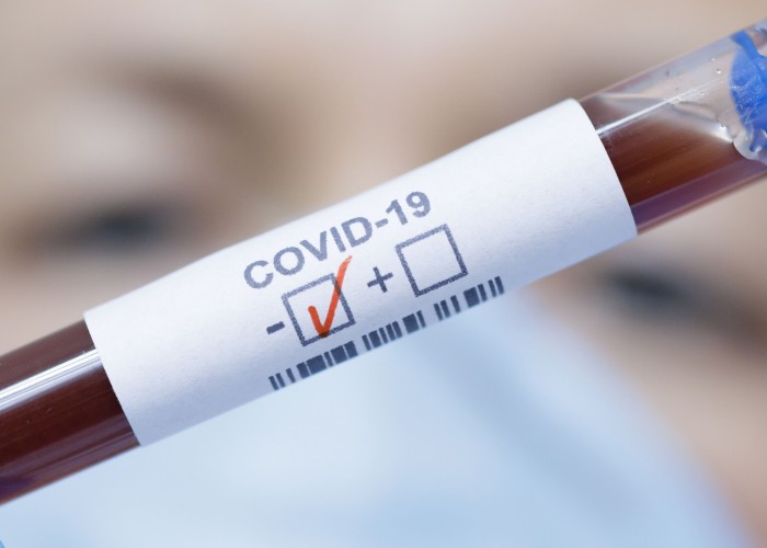 В Азербайджане выявлено 175 новых случаев заболевания COVID-19