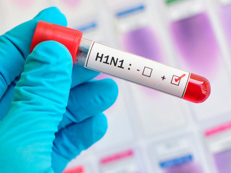 «Свиной грипп» возвращается: в Грузии два человека скончались от вируса H1N1 