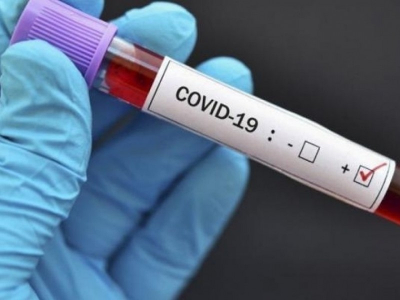 В Грузии фиксируют рост случаев коронавируса: 7812 заболели, выздоровели 4764 человека