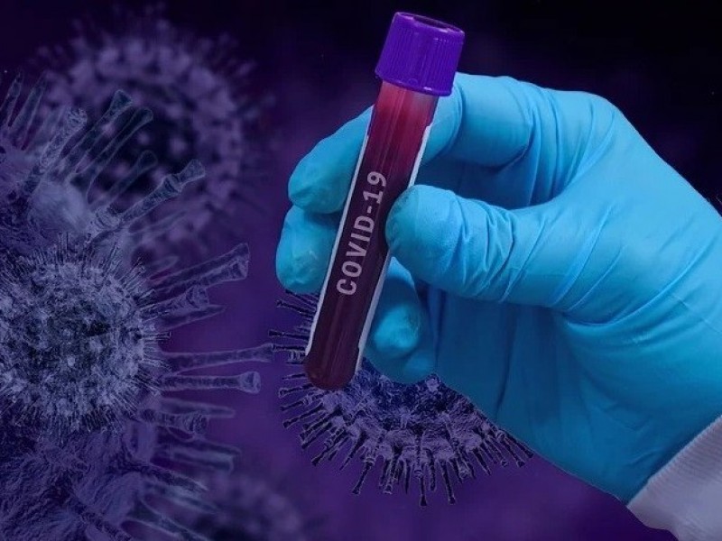 Вирусологи и иммунологи перечислили места с повышенным риском заражения коронавирусом
