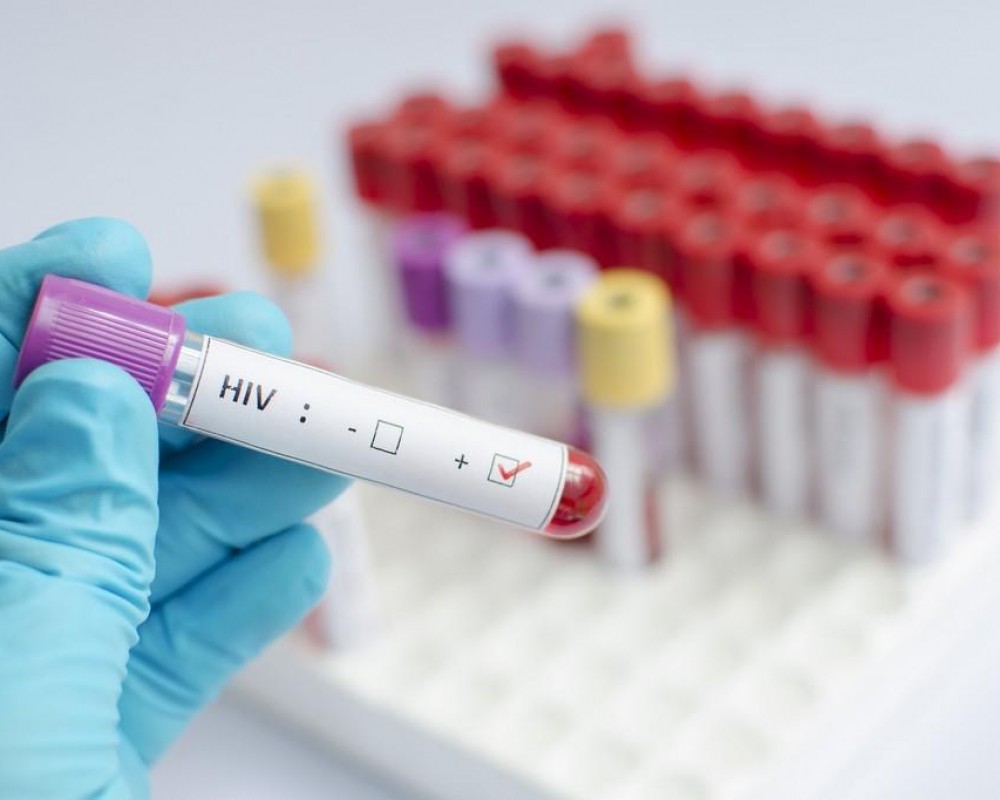 В Грузии растет количество ВИЧ-инфицированных