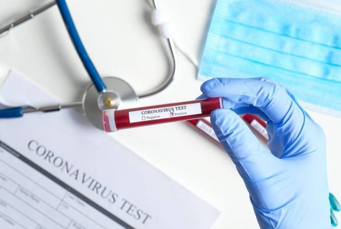 Тесты на коронавирус 5 человек в Ванадзоре оказались отрицательными 