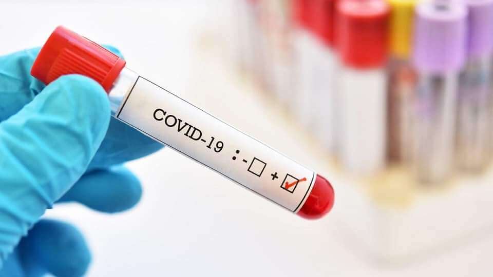 В Азербайджане 146 новых случаев инфицирования коронавирусом