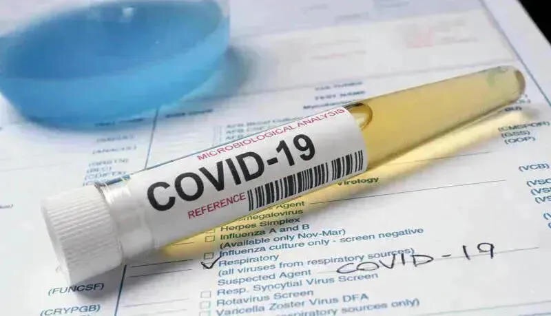 Վրաստանում Covid-19 նոր հակառեկորդ է գրանցվել. վարակվել է 45, բուժվել է 6 մարդ