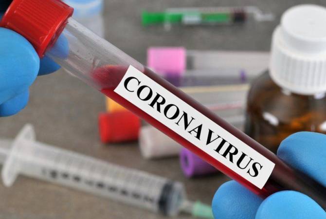 Число случаев коронавируса в Армении выросло до 33559: за сутки выявлено 554 больных