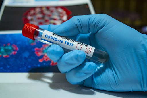 Плюс 11: число случаев коронавируса в Арцахе достигло 228