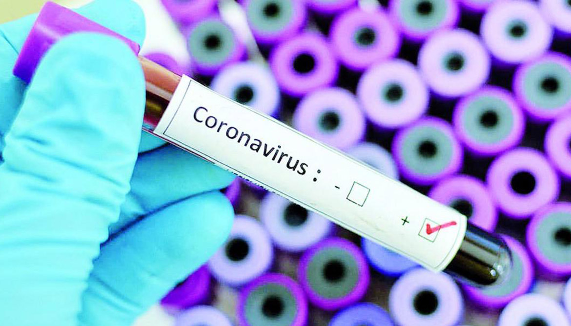 Число подтвержденных случаев заражения коронавирусом в Арцахе составляет 78