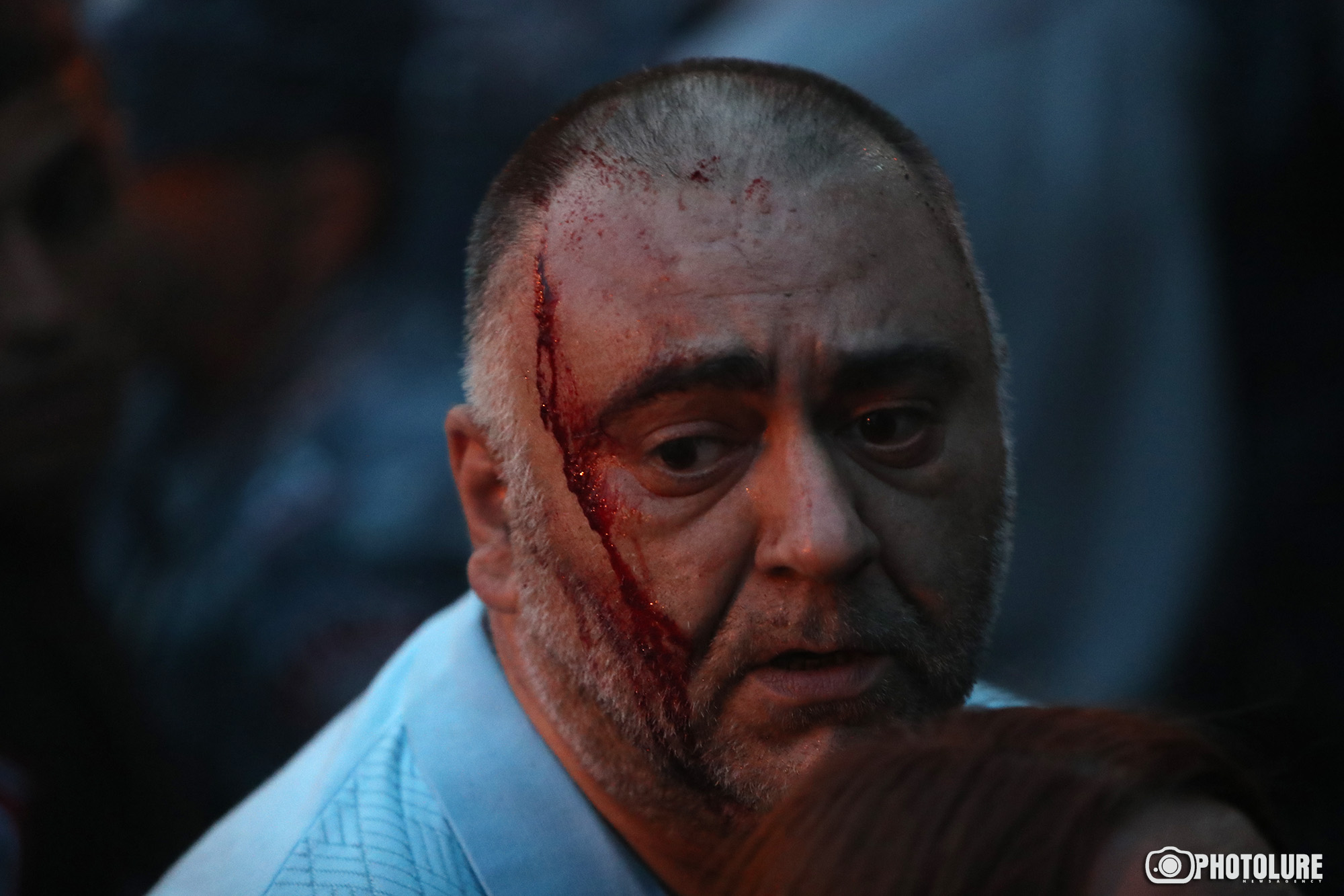 После столкновения демонстрантов с полицией в Ереване за медпомощью обратились 60 человек