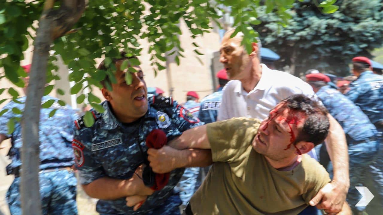 Избитые депутаты и демонстранты: полиция перешла к жестким действия (ФОТОРЕПОРТАЖ)