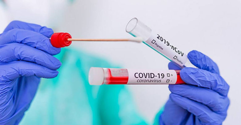 Директор ФБР: источником пандемии коронавируса стала лабораторная утечка в Ухане
