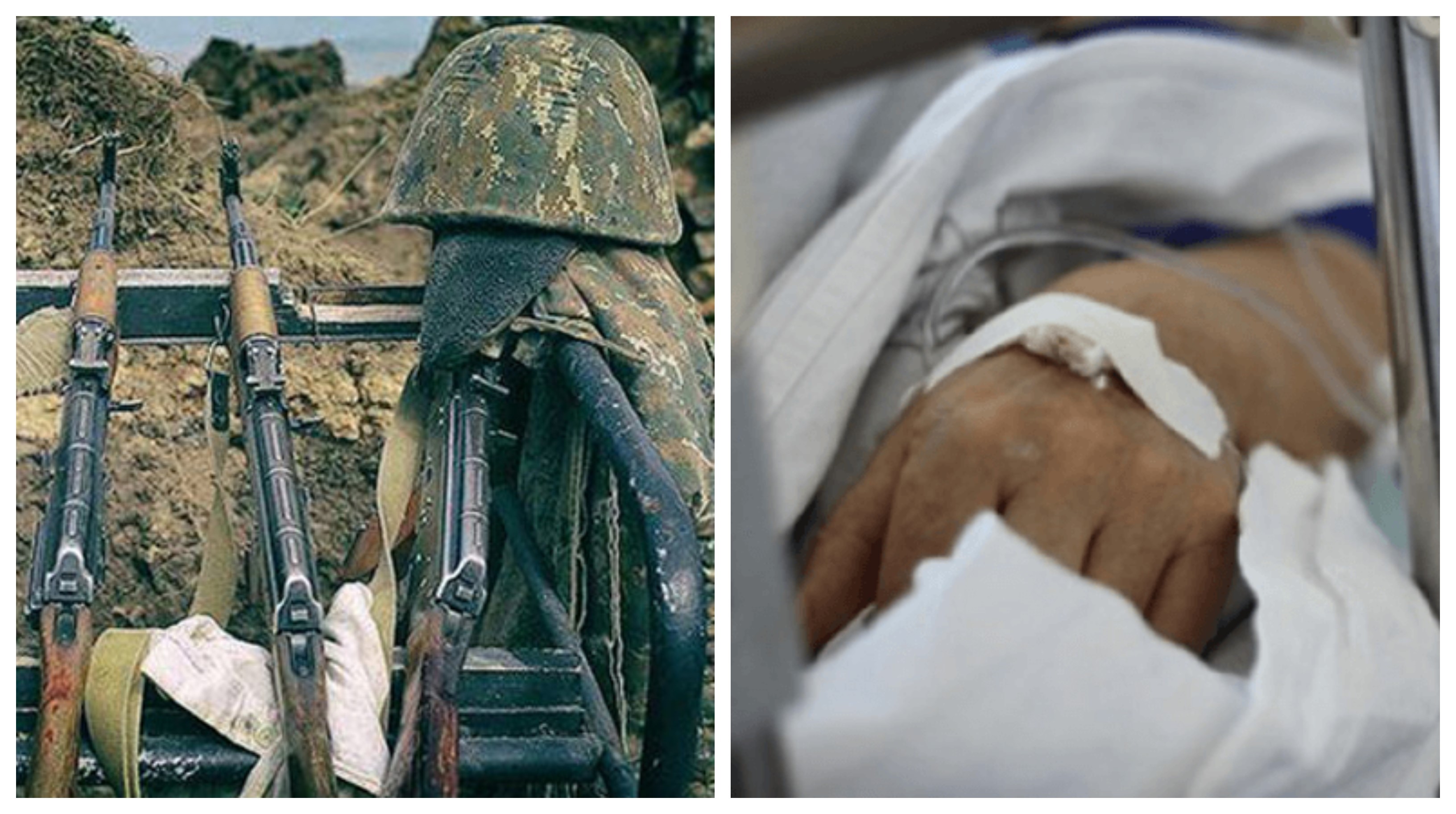 В результате обстрела ВС Азербайджана ранен армянский военнослужащий