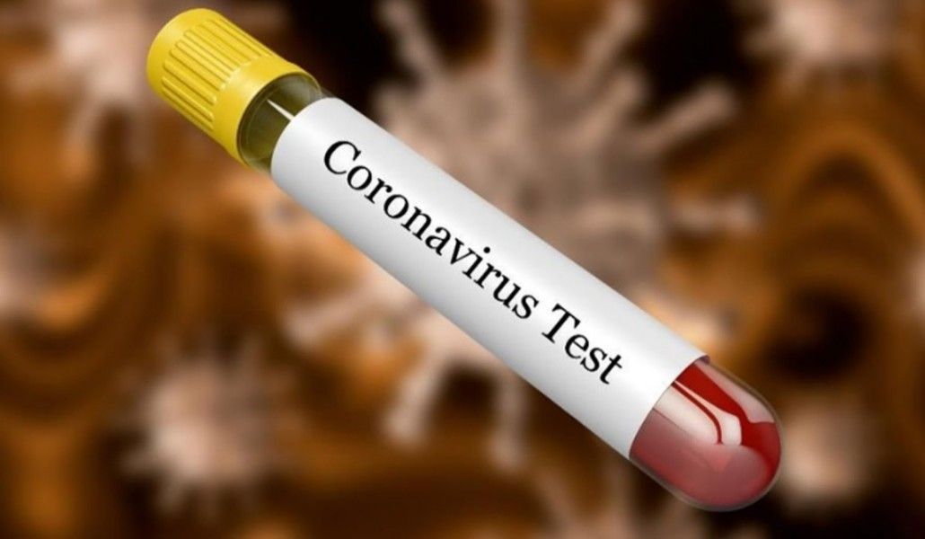 Плюс 6: число случаев коронавируса в Арцахе достигло 261