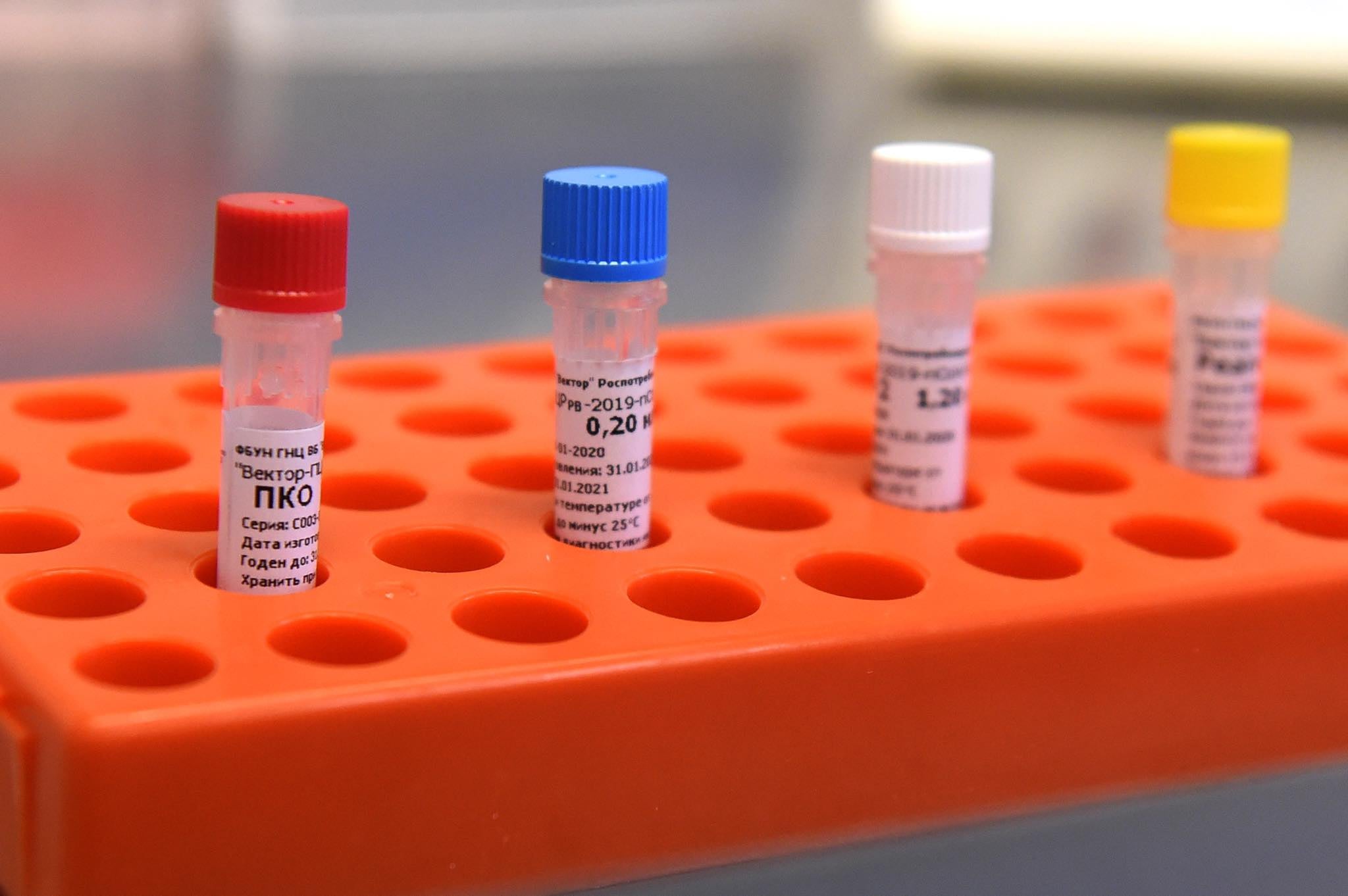 Կորոնավիրուսը գրոհում է. վարակվելու 2556 նոր դեպք, 3 մահ մեկ օրում 
