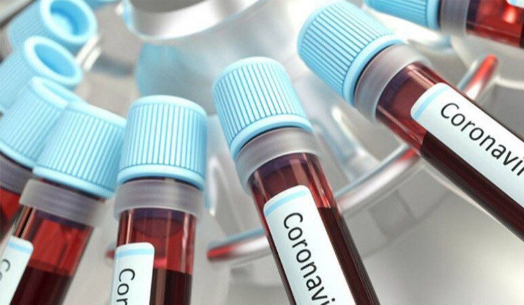 Коронавирус в Арцахе: 38 новых случаев заболевания и 2 смерти за сутки