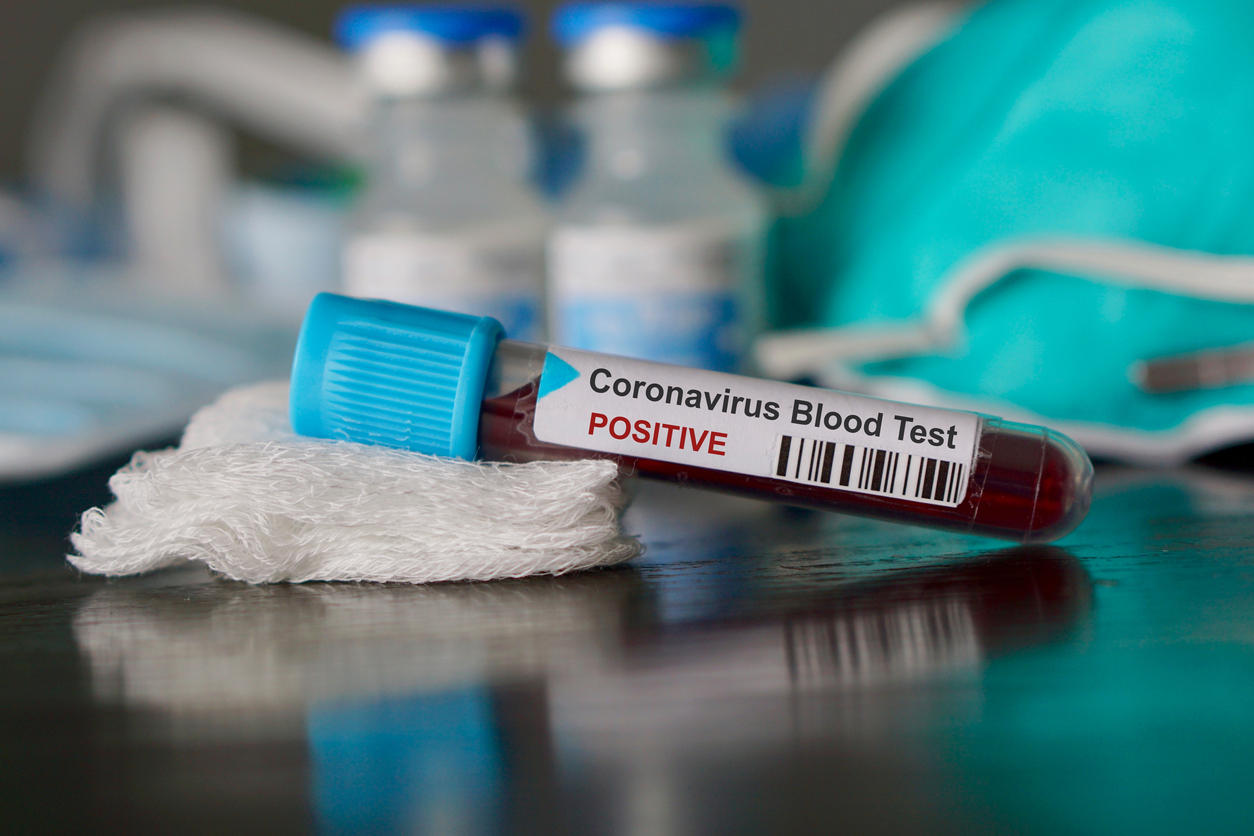 В Арцахе выявлено 4 случая заболевания коронавирусом, состояние 6 оценивается как тяжёлое 