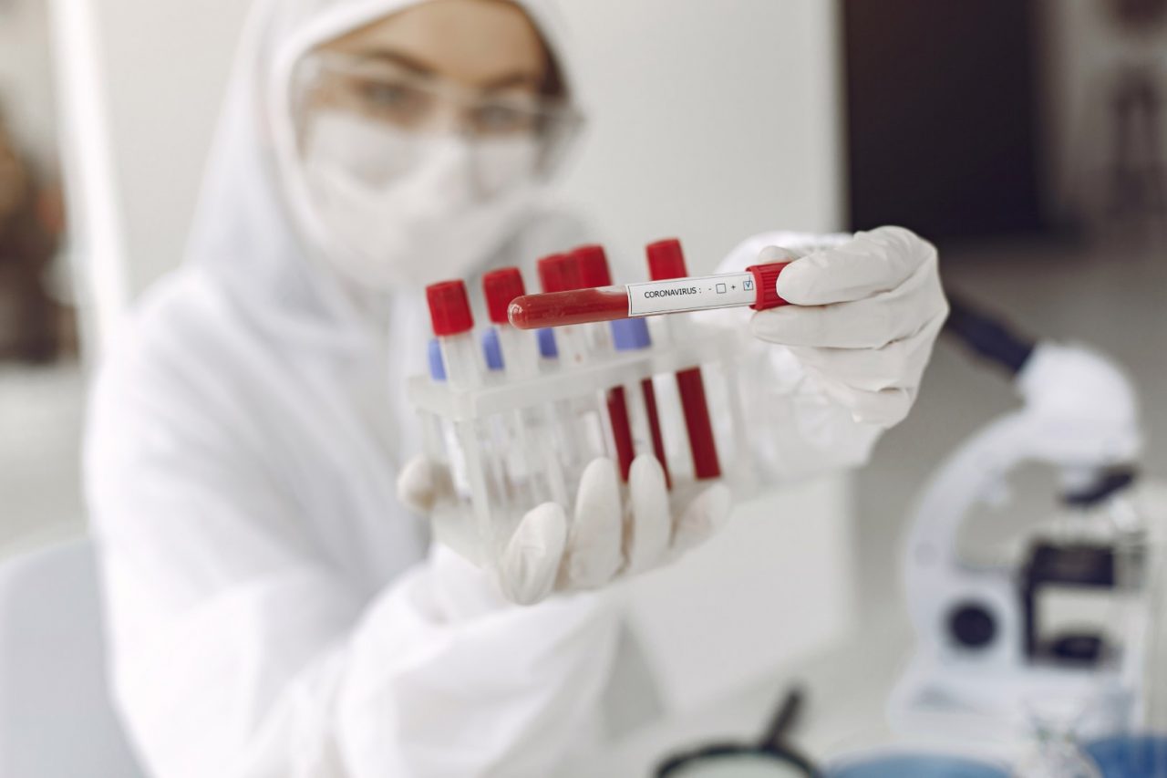 В Арцахе зарегистрировано 11 новых случаев заболевания коронавирусом