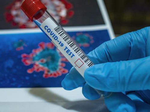 В Азербайджане 162 новых случаев инфицирования коронавирусом
