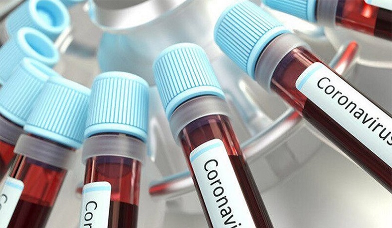 Արցախում գրանցվել է կորոնավիրուսային հիվանդության 37 նոր դեպքեր