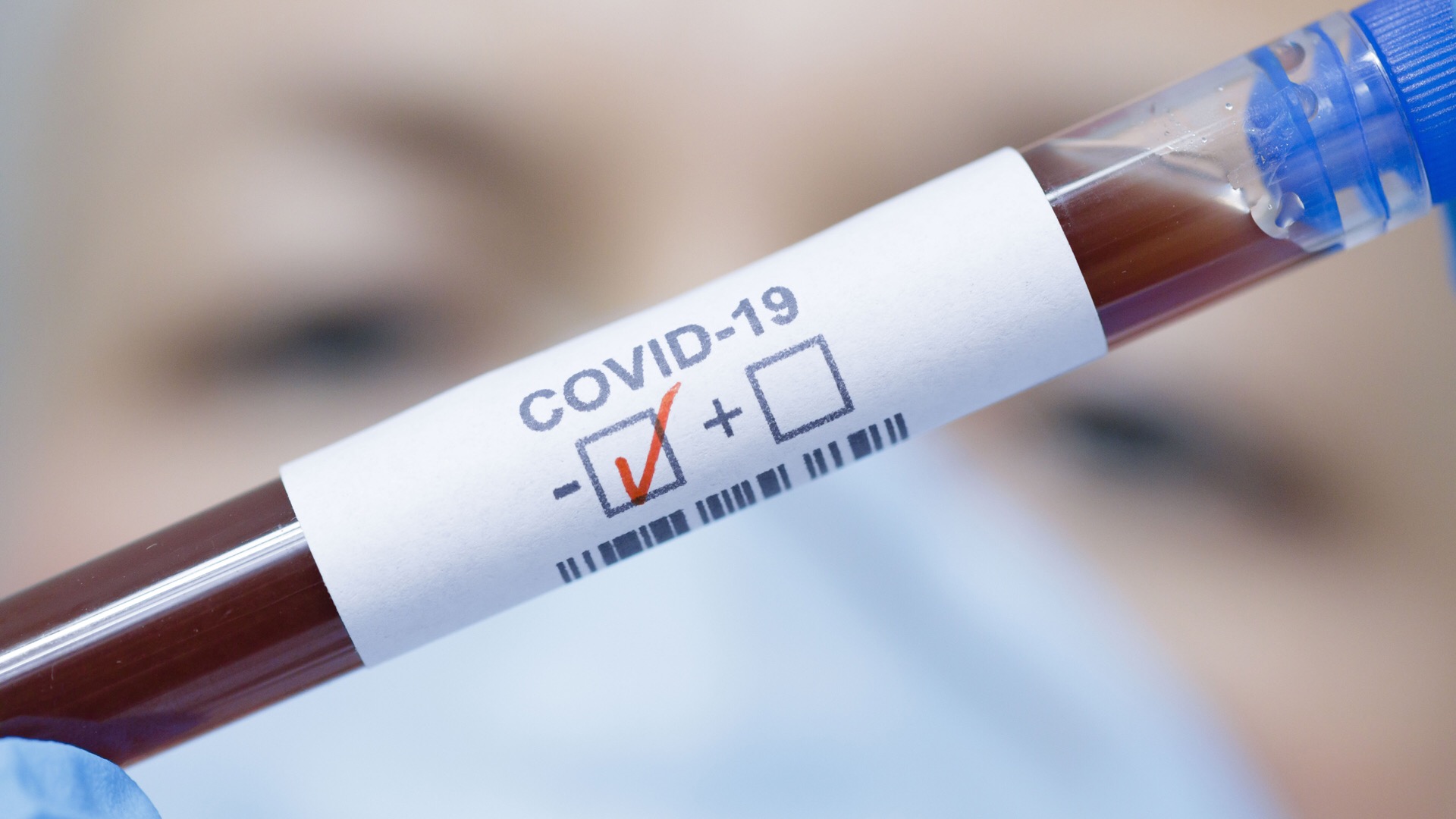 В Азербайджане выявлено 175 новых случаев заболевания COVID-19