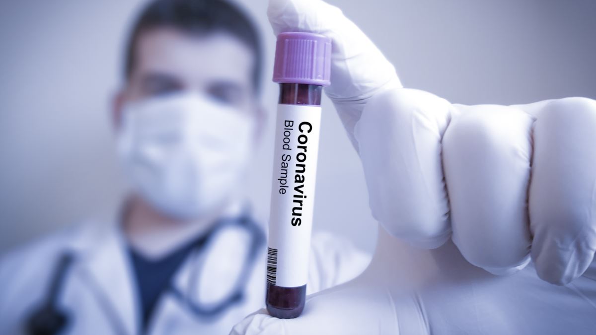 Число случаев коронавируса в Армении выросло до 42056: за сутки выявлено 210 больных