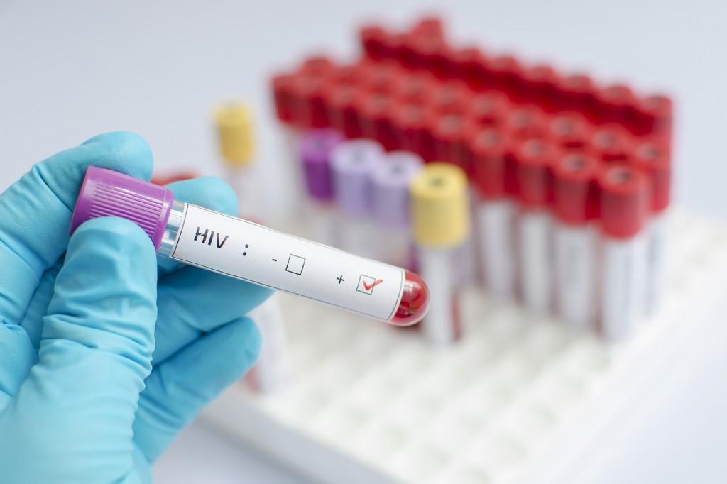 В Грузии растет количество ВИЧ-инфицированных